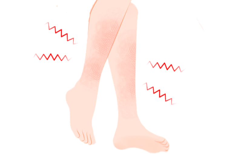 シンスプリント